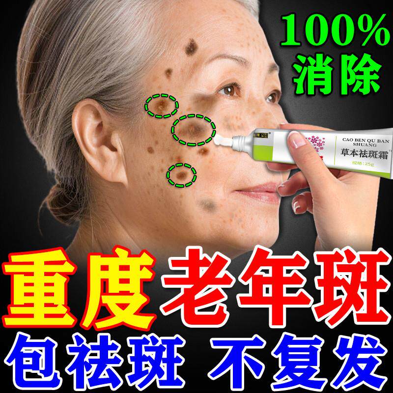 最近几个朋友给邮寄过来的黑膏药让鉴别制作的怎么样？[万柿如意]说实话做的差的太远了了这么多年以来真还没有看到一款像样的传统黑膏药[万柿如意]有的大夫说他的做的不错给我邮寄了几张我使用一点都不好并且粘的身上都是。二十多年以来接触传统非常多多则500多种类型(图1)