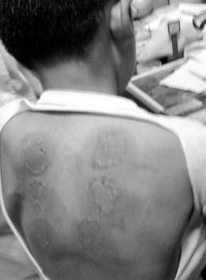 拜托你们了耳鸣就去看医生不要被这个药膏害惨了听他们忽悠买了30盒一点用都没有还不退货十足的智商税啊狗皮膏药。(图1)