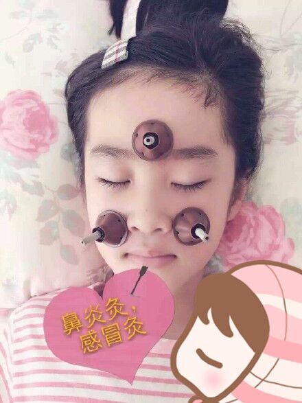 芯片设计(图1)