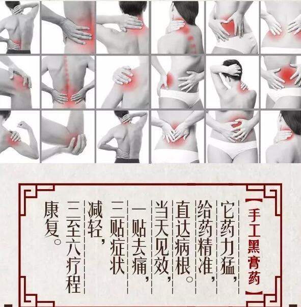 膏药你真的会贴吗?(图1)