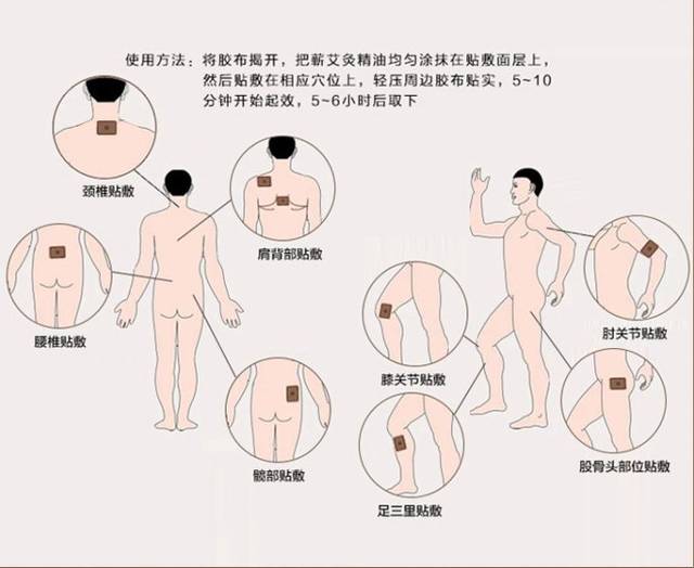 中医院:“大热守小安”健康宣讲让中医智慧沁润百姓心田(图1)