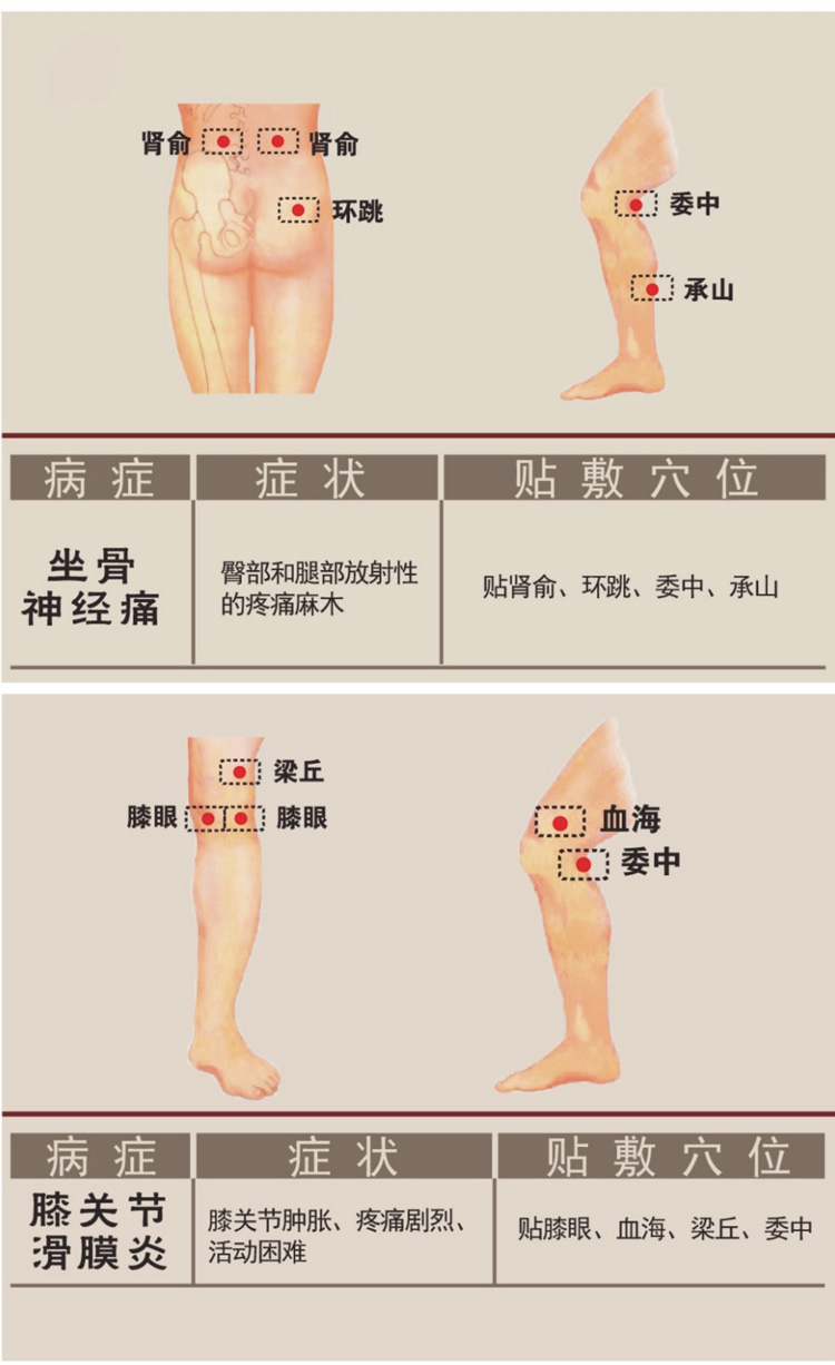 膏药穴位贴敷图(新)docx(图1)